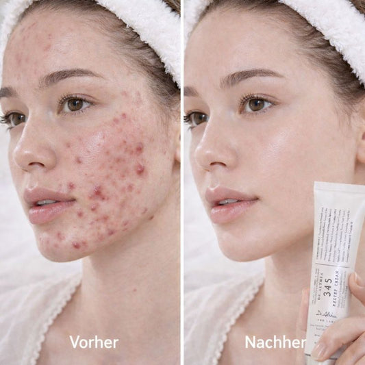 🌿Dr. Althea Für unreine und zu Akne neigende Haut